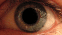 Dilatation de la pupille